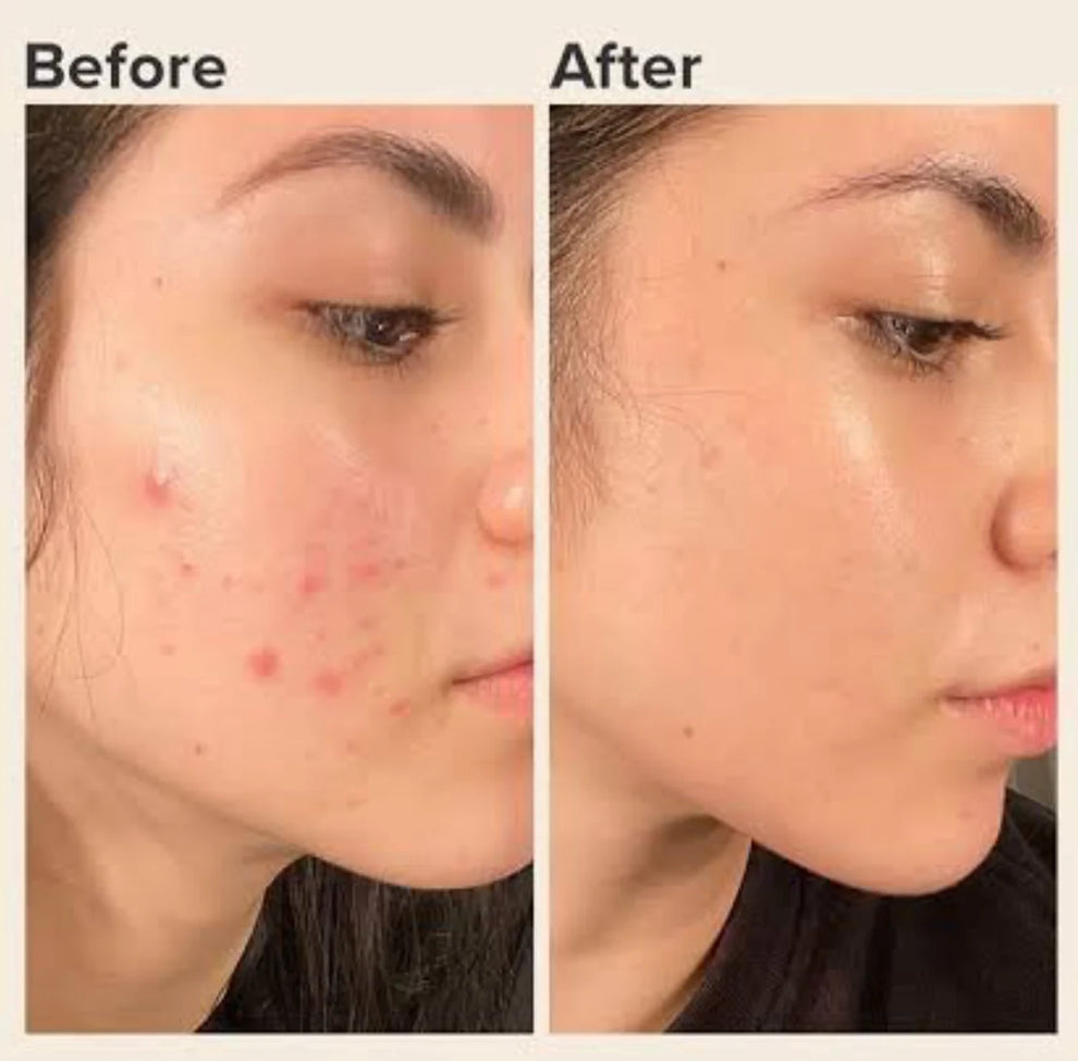 Zafrani Glow Gold Serum Cream - BUY 1 GET 1 FREE