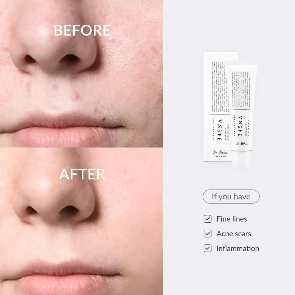 Dr. Althea 345 Relief Cream 50ml | Buy 1 Get 1 Free